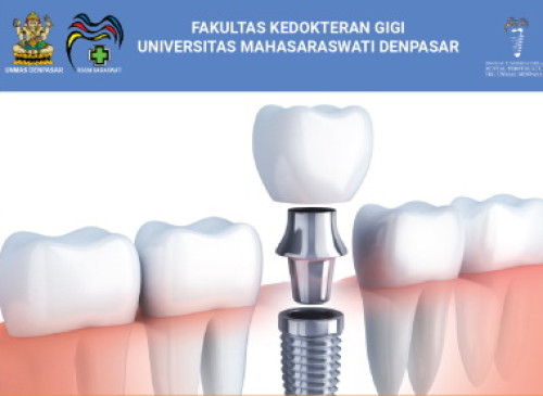 PROGRAM PENDIDIKAN IMPLAN DENTAL TERSTRUKTUR ANGKATAN X